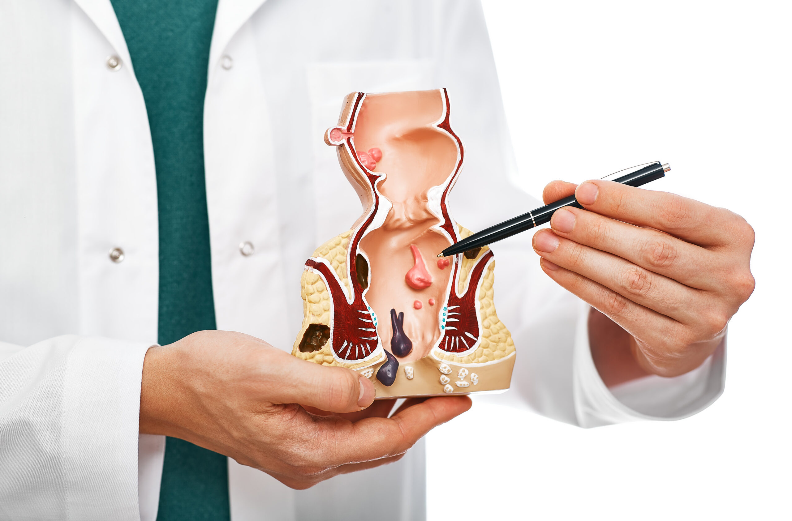Advances in Anorectal Diagnostics & Procedures